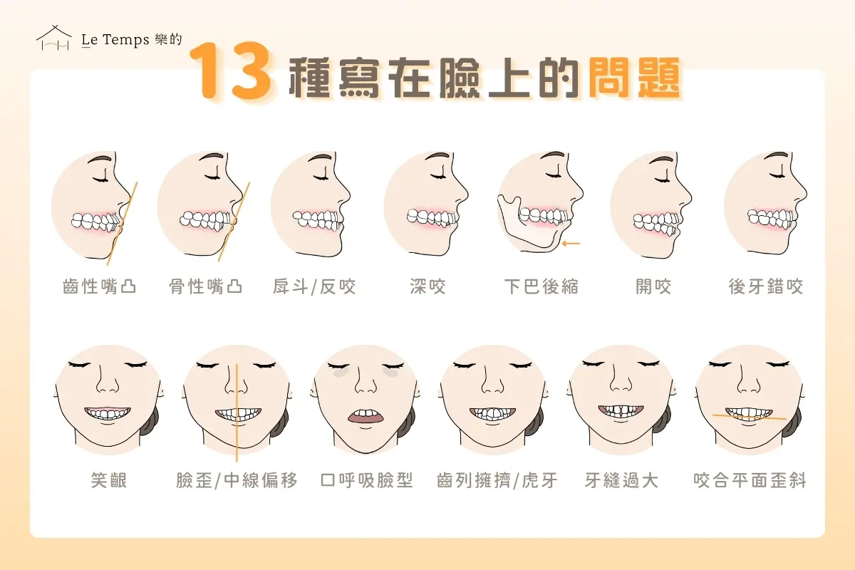13種齒列與臉型問題