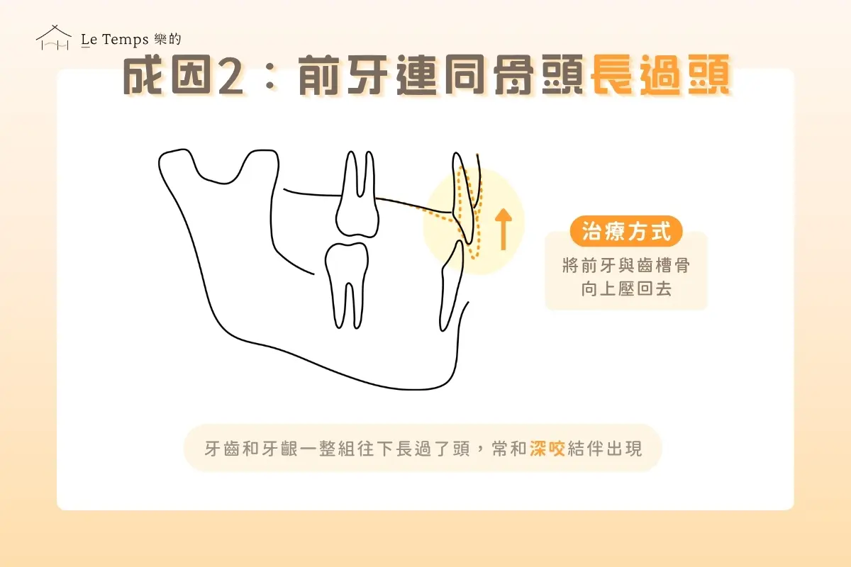 上排前牙連著齒槽長過頭