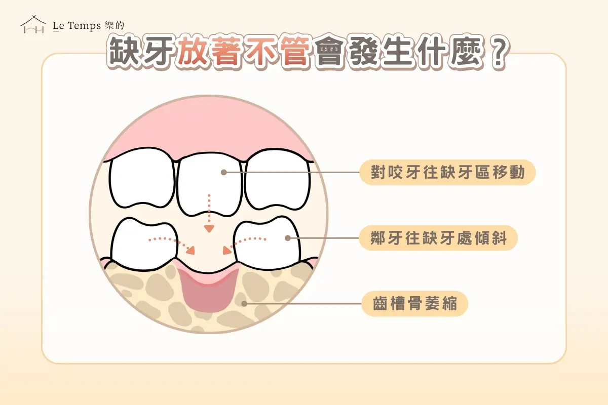 缺牙放著不管會發生什麼？