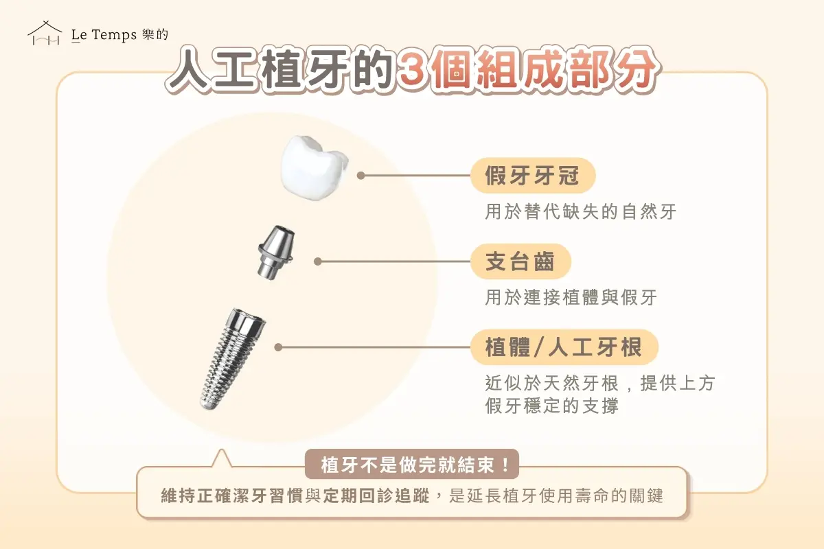 人工植牙的3個組成部分