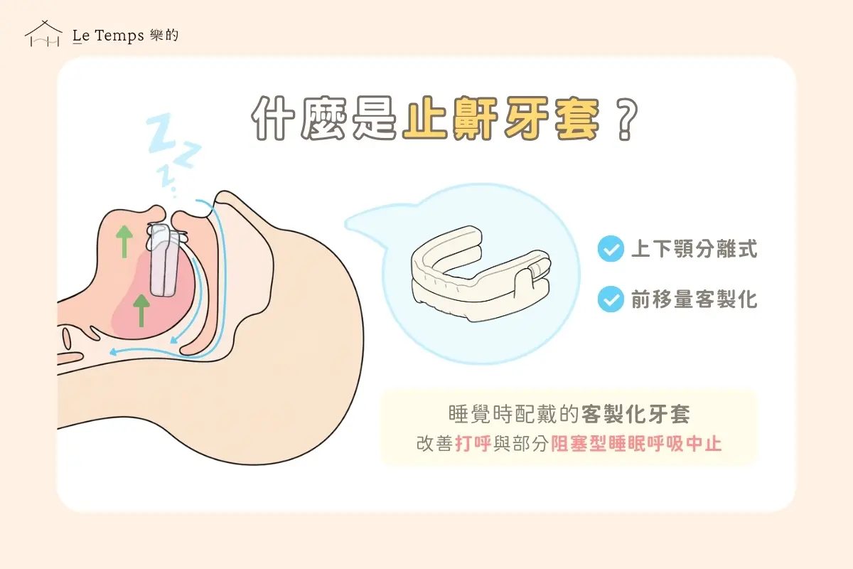 什麼是止鼾牙套 1