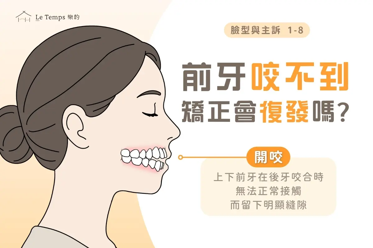 開咬：前牙咬不到，矯正治得好嗎？為什麼容易再開？