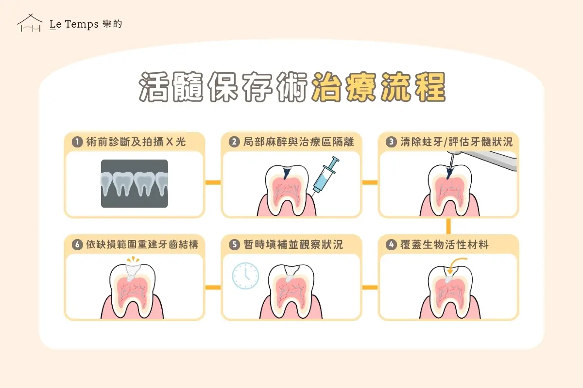 活髓保存術治療流程