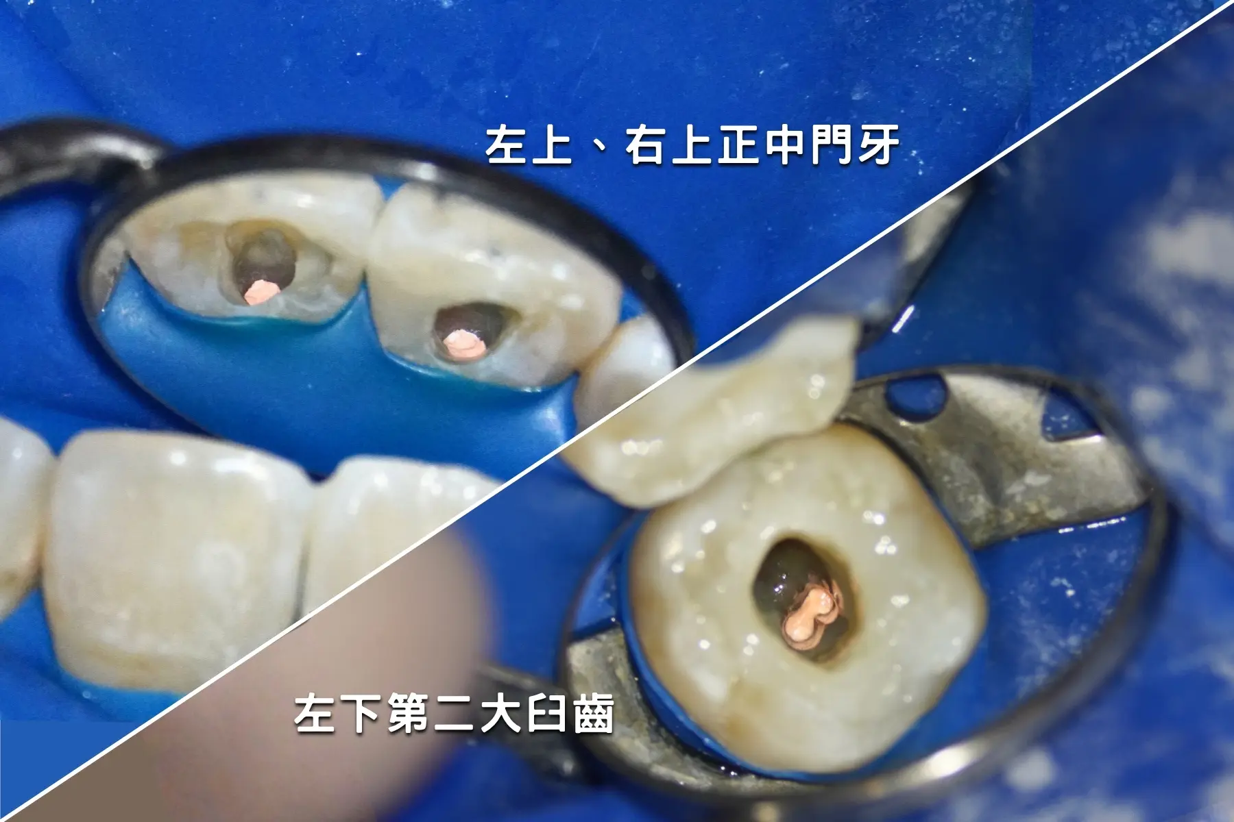 術後 59