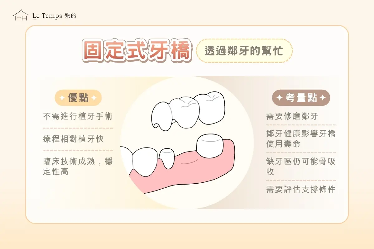 固定式牙橋優點與考量點