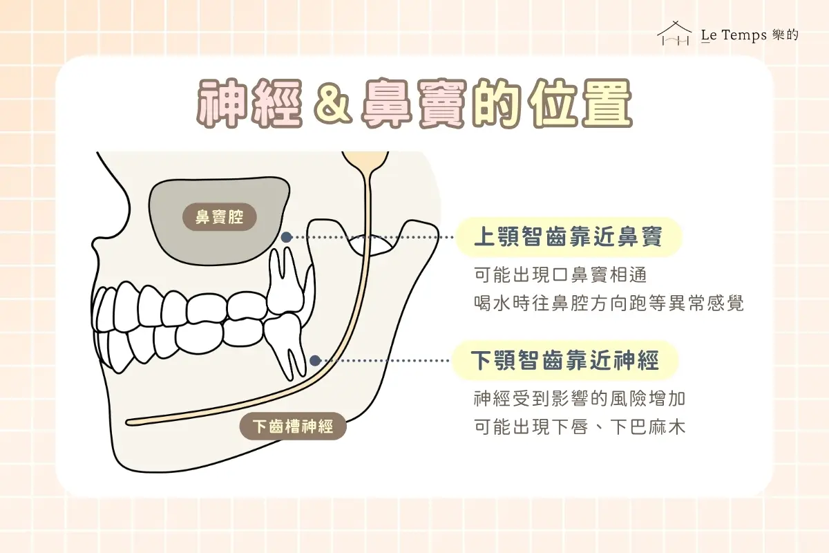下齒槽神經與鼻竇位置